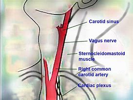 Image result for Carotid Sinus in the Neck
