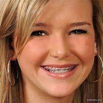 Image result for Girls with Pink Braces