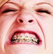 Image result for How to Make Fake Braces That Look Real