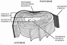 Image result for untervertebral