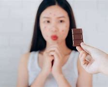 Image result for Chocolate Allergy Symptoms