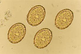 Image result for Telur Ascaris Lumbricoides