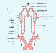 Image result for Vertebral Arteris and Carotid Arteries