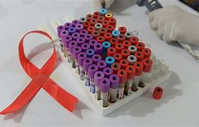 Image result for HIV infection