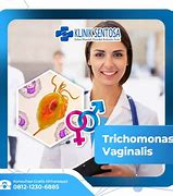 Image result for Trichomoniasis Vaginalis Symptoms