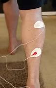 Image result for Devices to Use for Plantar Fasciitis