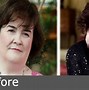 Image result for Susan Boyle Weight Loss
