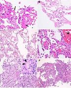 Image result for Histopathology