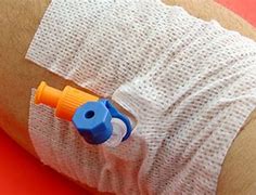 Image result for IV Catheter Colors