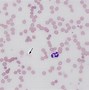 Image result for Ghost Cells in Physiology