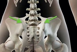 Image result for Chiropractic for Si Joint Pain