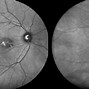 Image result for Retinal Scanner