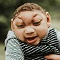 Image result for Baby with Microcephaly