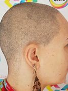 Image result for alopecuro