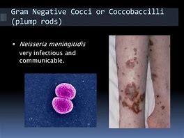 Image result for Diplococci On Skin