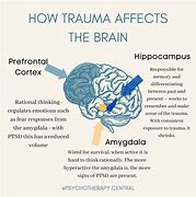 Image result for Impacts Memory and Trauma