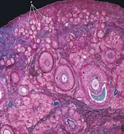 Image result for Ovary Histology Slide