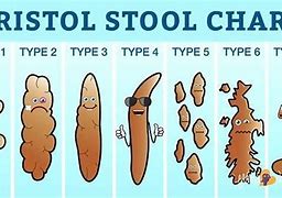 Image result for World Largest Bowel Movement Funny