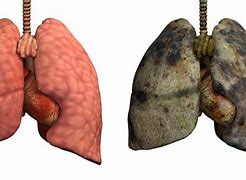 Image result for Tar Diseased Lungs