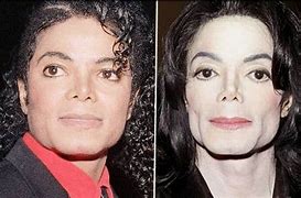 Image result for Mitchel Jackson Before and After