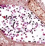 Image result for C. Trachomatis Gram Stain Formation