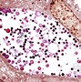 Image result for Chlamydia Gram Stain