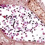 Image result for Chlamydia Gram Stain