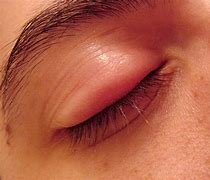 Image result for Eyes Bugging Out
