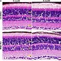 Image result for Ganglion Cell Layer Retina