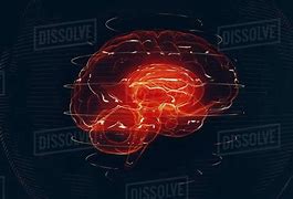 Image result for Brain Scan with Neurons Firing