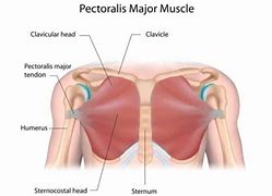 Image result for Pectoralis Major Muscle Tear