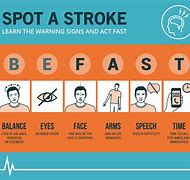 Image result for Fast Recovery Patient