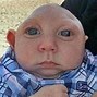 Image result for Baby with No Brain