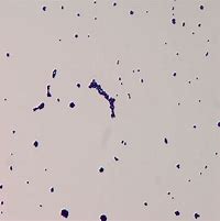 Image result for CSF Gram Stain