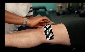 Image result for Patellofemoral Pain Syndrome Taping
