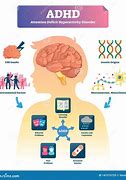 Image result for ADHD Brain Clip Art