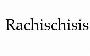 Image result for Rachischisis