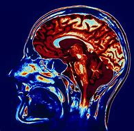 Image result for Human Brain Scan