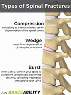 Image result for Compression Fracture Lumbar Spine