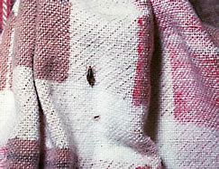 Image result for Clothing Lice