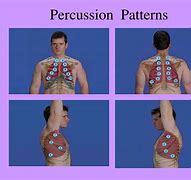 Image result for Thoracic Percussion