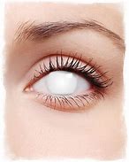 Image result for White Contacts