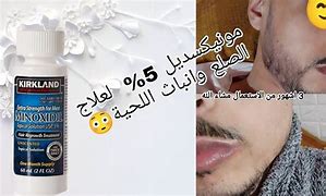 Image result for سعر المنكسديل