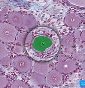 Image result for Ganglion Cell