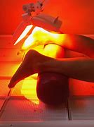 Image result for Infrared Radiation Therapy