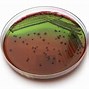 Image result for Forms of Escherichia Coli