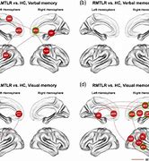 Image result for Encoding Memory