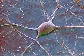 Image result for Nerve Cell Sem