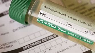 Image result for Chlamydia Vaccine