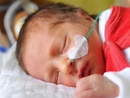 Image result for Hydranencephaly Disease